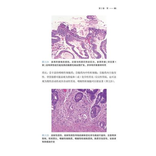 消化道黏膜病理活检解读（原书第3版） 商品图1