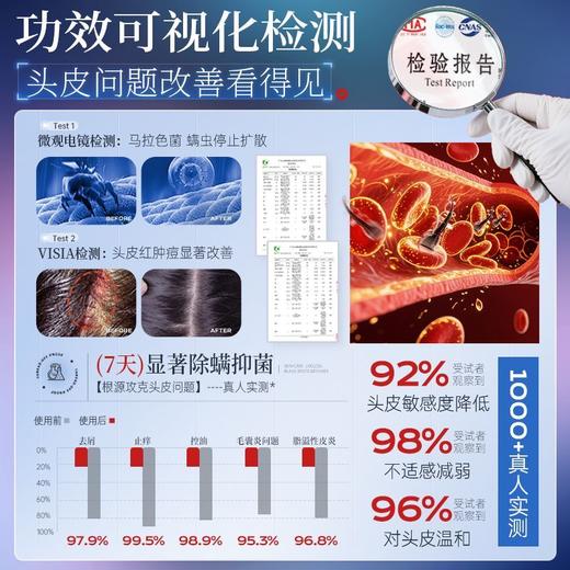 OHBT二硫化硒毛囊护理去屑洗发水800g 商品图2