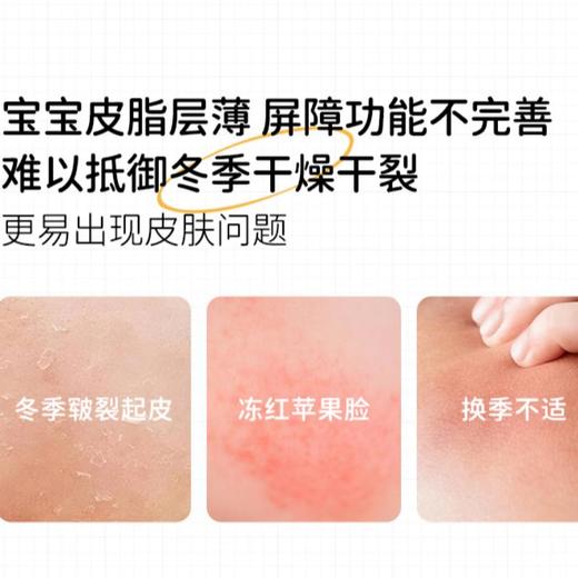 VALGER薇尔佳 儿童高保湿舒缓面霜50g 商品图1