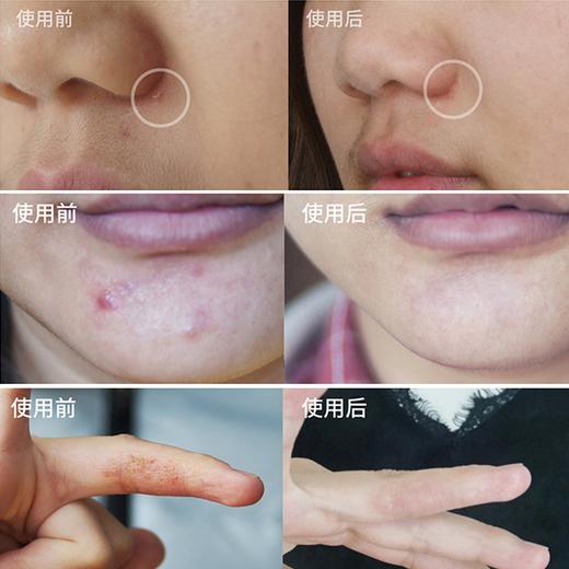 蜂舒坦皮肤凝胶｜农科院60年研发成果，皮肤黄金修复，止痒消炎不留疤 商品图2