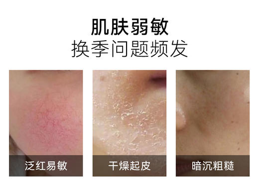【购物先领券】敬修堂红没药醇舒缓修护精华水90ml+乳30g+霜30g 三件套 肌肤修护抗敏感搭配祛斑产品使用 效期26年5月 商品图2