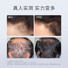 Hairmax激光生发仪 LaserBand 82Pro +胶原蛋白洗发水240ml*3瓶【赠水光仪*1+精华水60ml*4+护发素300ml*2+气垫梳*1+收纳包*1+干发帽*1】 商品缩略图2