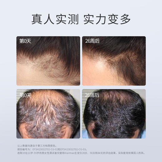 Hairmax激光生发仪 LaserBand 82Pro +胶原蛋白洗发水240ml*3瓶【赠水光仪*1+精华水60ml*4+护发素300ml*2+气垫梳*1+收纳包*1+干发帽*1】 商品图2
