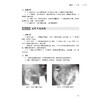 实用胃肠道 双重对比造影图谱 第2二版 王爱英 系统介绍胃肠双重造影诊断的图谱类书籍 含有大量病例资料等 北京大学医学出版社 商品缩略图4