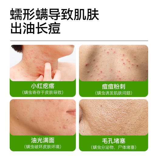 5块划算 控油祛痘皂108g， 祛痘+止痒+嫩白+男士108g——加入会员下单享8折，满69元送满婷清满保湿洁面乳，满119元送祛痘控油沐浴乳 商品图2
