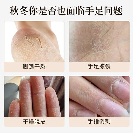 热卖中！！【创办于1424年 600年老品牌历史传承！线下25w+药店同时在售】永安虎标红花皲裂抑菌膏 秋冬脚手裂口  干燥起皮 无刺激 儿童老人均可使用 商品图1