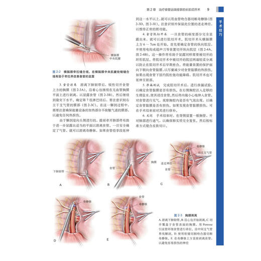 前肠外科手术技巧 中文翻译版 原著第2版 外科手术技巧丛书 顾岩 沈晓咏 主译 本书适合普外科的各级医师医师等参考阅读科学出版社 商品图4