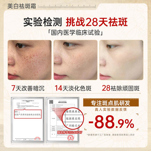 【微信会员专属】瑜然美美白祛斑面霜高浓度淡斑黄褐斑老年斑色斑补水保湿提亮肤色 商品图2