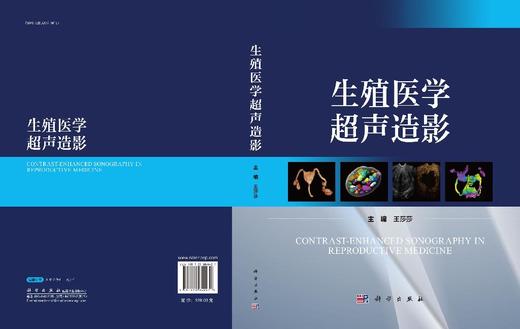 生殖医学超声造影 商品图3