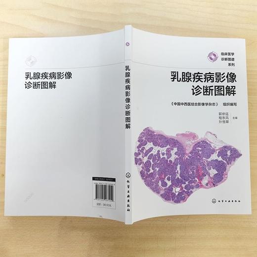 乳腺疾病影像诊断图解 商品图1