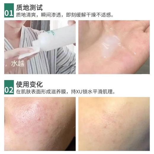 Albion/澳尔滨健康水精华水爽肤水 补水祛痘化妆水保湿水护肤舒缓官方正品 商品图4