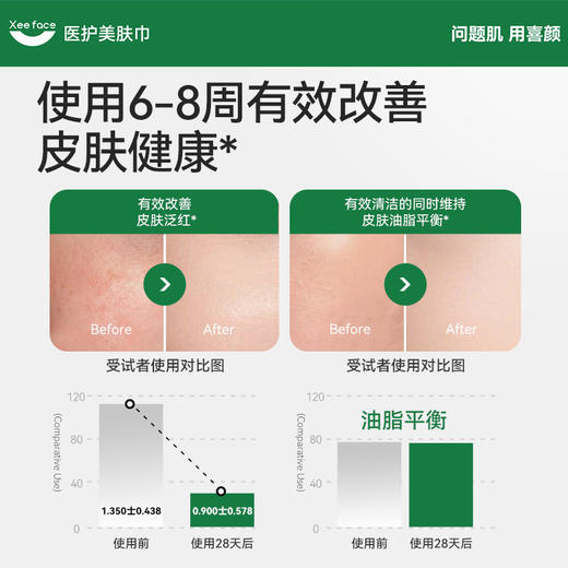 喜颜美肤巾医护级免洗面奶洗脸巾青少年敏感肌适用 柔软加厚干湿两用洁面巾 商品图2