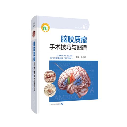 脑胶质瘤手术技巧与图谱 商品图0