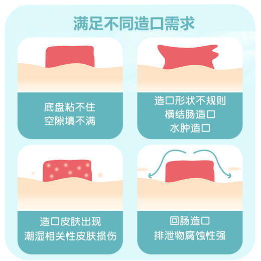 可孚可塑贴环造口护理用品造口袋造瘘底盘防漏贴防漏圈密封弹力胶 商品图2