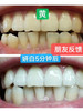 【🔥买赠研白牙刷4支装+漱口水3条装*1】研白多效美白牙膏家庭必备套装 商品缩略图5
