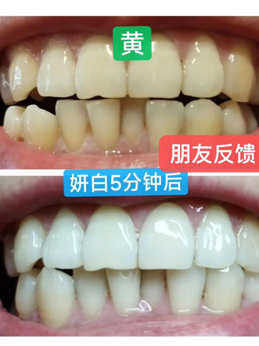 【🔥买赠研白牙刷4支装+漱口水3条装*1】研白多效美白牙膏家庭必备套装 商品图5
