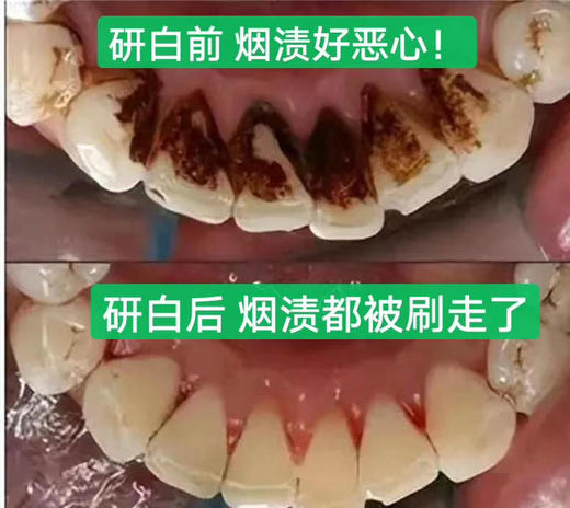 【🔥买赠研白牙刷4支装+漱口水3条装*1】研白多效美白牙膏家庭必备套装 商品图4