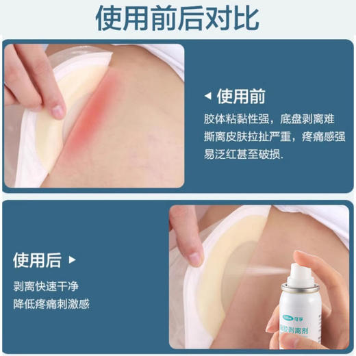 【限时65折】可孚造口袋护理用品黏胶去除医用剥离剂75ml 商品图4