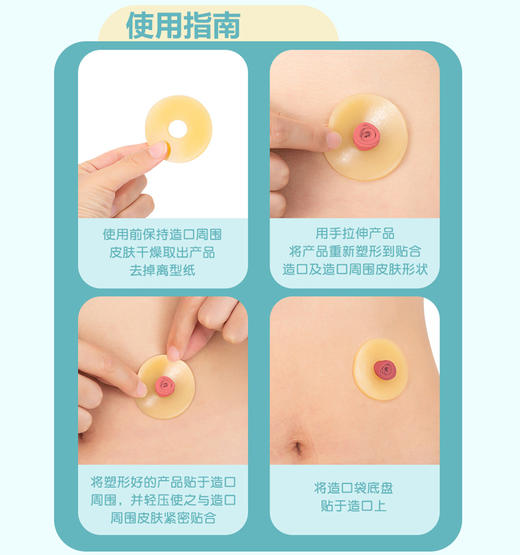 可孚可塑贴环造口护理用品造口袋造瘘底盘防漏贴防漏圈密封弹力胶 商品图3