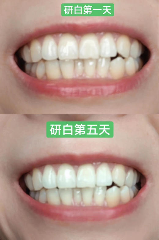 【🔥买赠研白牙刷4支装+漱口水3条装*1】研白多效美白牙膏家庭必备套装 商品图2