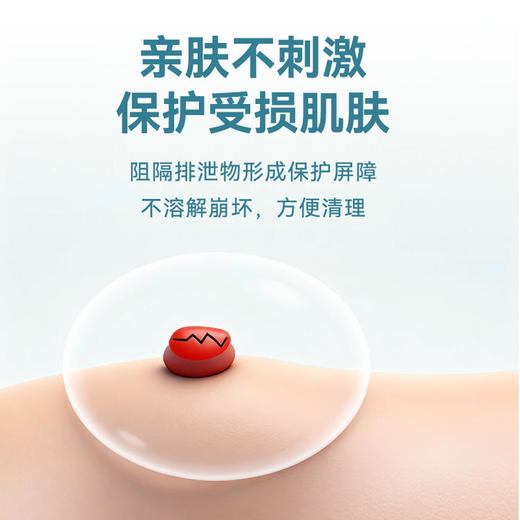 【最新款防漏圈】可孚硅凝胶防漏可塑贴环造瘘口护理用品造口袋防漏圈条官方旗舰店 商品图3