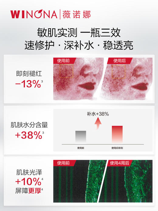 薇诺娜 | 舒敏保湿特护精华水(舒敏保湿润肤水) 120ml | 修护舒缓肌肤 修护屏障 缓解不适 减轻刺激 深入补水保湿 商品图2