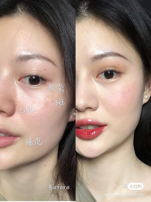 C-PB新版长管隔离 商品图6