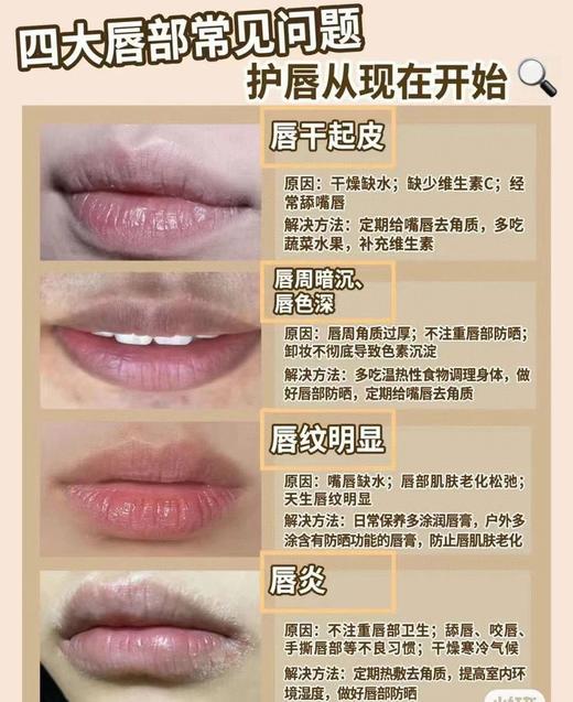 医用级护唇抗菌膏9.8元1支10ml，明天到 商品图4