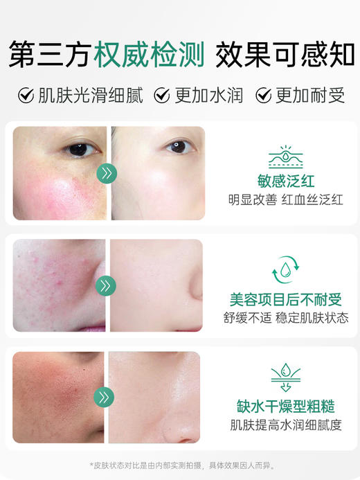 【速舒缓快修护 敏红肌急救包】 透真重组胶原蛋白修护面膜B5敏感肌舒缓晒后修护熬夜急救补水保湿 商品图4