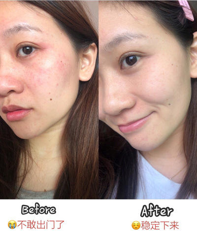 【到手2瓶】米蓓尔保湿舒缓水100ml 商品图4