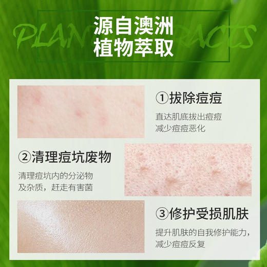 【多妈团购 明星同款Lalisse莱依诗祛痘精华】青春期必备 中草药香，温和祛痘，植物萃取不伤肤，祛痘、淡印，少反复好吸收，自带滚珠，好涂抹，效果肉眼可见-咸喜仓 商品图3