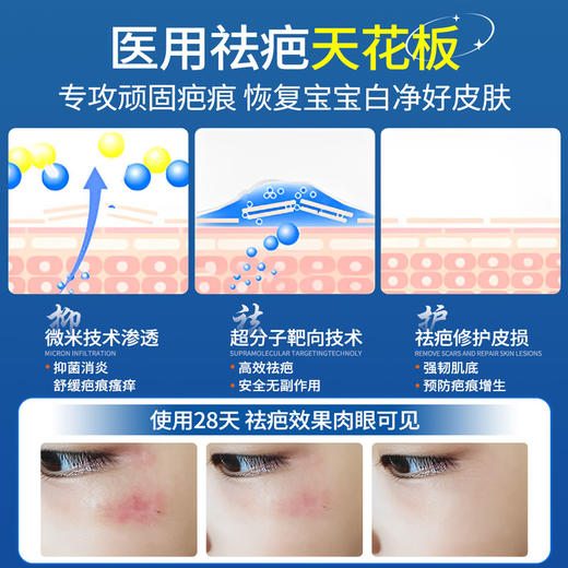 Panapopo医用疤痕修复凝胶（15g/支） 商品图2