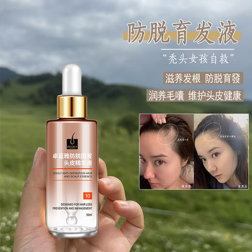 卓蓝雅防脱固发头皮精华液 商品图0