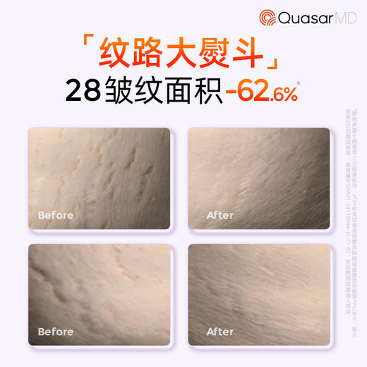 科施佳光塑小蛮腰腰带【赠送科施佳599元美唇仪+5片科施佳焕颜舒缓水润冻干面膜+科施佳盈润舒缓精华乳*3（瓶）+清洁湿巾*4（包）】 商品图3