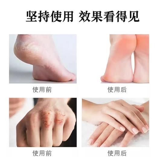 【到手4盒200贴，会“呼吸”的马油贴】积草堂马油干裂贴 商品图3