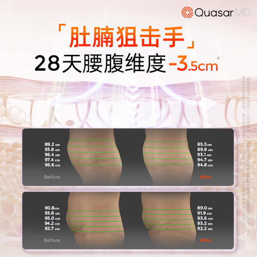 科施佳光塑小蛮腰腰带【赠送科施佳599元美唇仪+5片科施佳焕颜舒缓水润冻干面膜+科施佳盈润舒缓精华乳*3（瓶）+清洁湿巾*4（包）】 商品图2