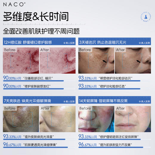【老客专属福利】NACO氨甲环酸精华液50ml/瓶 #保湿舒缓+褪黑提亮+修护强韧 商品图1
