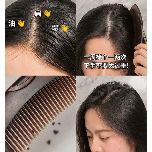 超值29.9俩把！【齿头圆润不伤头皮❗️握柄质感满满】梳头皮空心梳油头第三四代免洗头气囊按摩去油脂清洁梳子皮屑礼盒。ja 商品图2