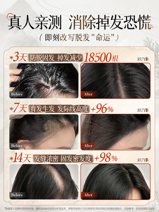 【防脱类国妆特字认证】儒意·防脱固根洗发水 8倍高活性小黄姜精华 激活毛囊 强健发根 72小时控油蓬松 去屑止痒 500ml/瓶 商品图3