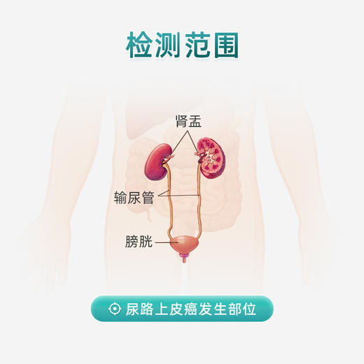 【邮寄】尿立检尿路上皮癌膀胱癌早筛 商品图1