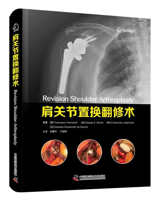 肩关节置换翻修术  主译 何耀华 万俊明  辽科出版 商品图0