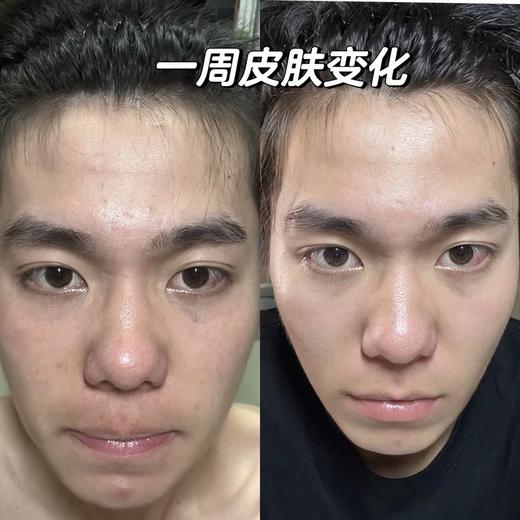 【多妈团购 满婷男士清满保湿嫩肤乳液（临期特价29.9到手2瓶）】专为男士肌肤研发而成，滋润保湿➕清爽控油，平衡水油，提亮肤色-特购汇 商品图8