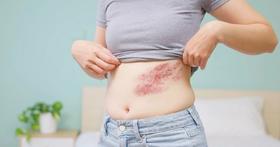 41岁知名女歌手自曝确诊！虽及时治疗，但……