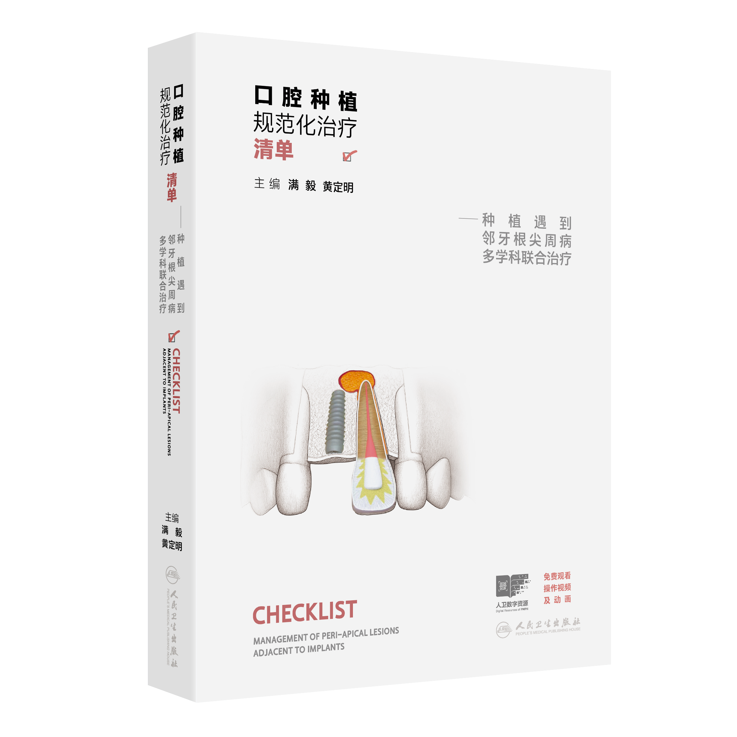 口腔种植规范化治疗清单——种植遇到邻牙根尖周病多学科联合治疗