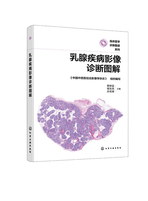 乳腺疾病影像诊断图解 商品图0