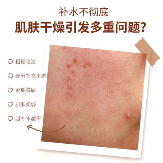 【BIOHYALUX/润百颜】第二代润百颜香槟水 300ml/瓶 商品图1