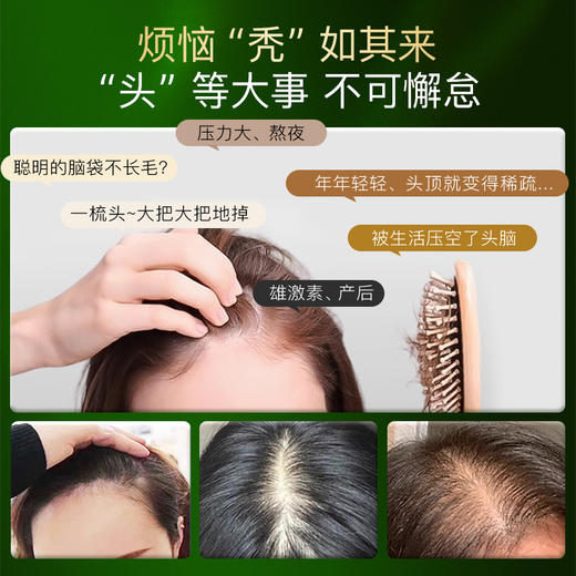 Mama Mujer 乌飞姿饮Pro瑞士豌豆苗三文鱼铁蛋白肽生物素酵母饮 毛毛饮 压力性 缺铁性 发际线  9支/盒 MMMJ 国内发货 商品图1