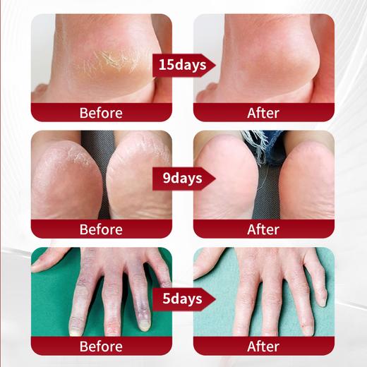 【清仓特惠！】Cinmose辛莫斯手足修护膏  效期至26年8月底 商品图9