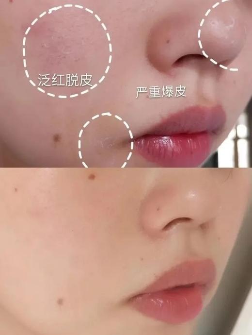 二店y 补水刚需【新版科颜氏高保湿面霜125ml】 商品图12