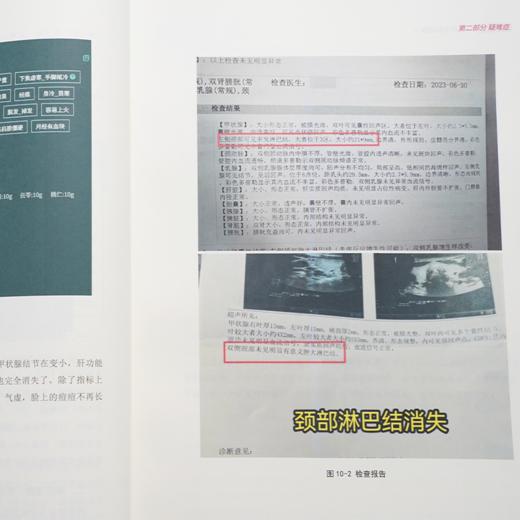 AI岐黄——中医大脑精选医案集2 商品图3